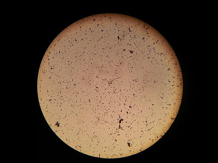 bacterie, microscoop, microscopisch, beeld, microscopisch beeld, wetenschap, Onderzoek, biologie, geen mensen, microbiologie, kolonie, vergroting, geometrische vorm, cirkel, zwarte achtergrond, opleiding, optisch instrument, binnenshuis, natuur, labuitrusting, vorm, detailopname, studio opname, ruimte, 2K, CC0, publiek domein, royaltyvrij