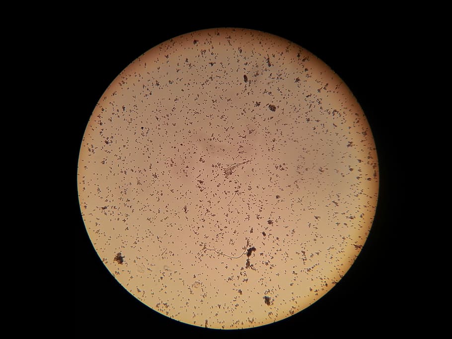 bacteris, microscopi, microscòpic, imatge, imatge microscòpica, ciència, recerca, biologia, cap gent, microbiologia, colònia, ampliació, forma geomètrica, cercle, fons negre, educació, instrument òptic, a l'interior, naturalesa, equips de laboratori, forma, primer pla, tir de l'estudi, espai, 2K