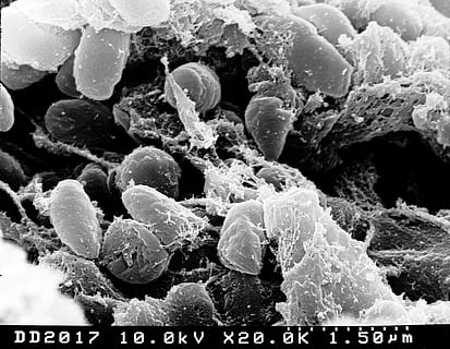 pestis, bakteri, penyakit pes, mikroskop elektron, memindai, mikroskopis, penyakit, wabah, medis, teknologi, alam, Es, suhu dingin, tidak ada orang, bingkai penuh, merapatkan, beku, keindahan di alam, ilmu, musim dingin, biologi, pembesaran, air, pertumbuhan, hari, invertebrata, dalam ruangan, satwa liar hewan, binatang di alam liar, 1080P, CC0, domain publik, bebas royalti