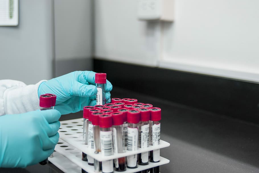 persona, col·locació, proveta de sang, prestatge, laboratori, experimentar, prova, química, guant de protecció, ciència, roba de treball protectora, recerca, protecció, salut i medicina, experiment científic, educació, científic, mà humana, ocupació, mà, seguretat, investigació mèdica, a l'interior, celebració, part del cos humà, proveta, una persona, biologia, analitzar, guant quirúrgic, rack de proveta, 4K