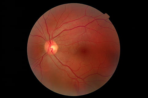 Auge, Fundus, schließen, schwarzer Hintergrund, einzelnes Objekt, keine Leute, Nahansicht, rot, drinnen, Studioaufnahme, Wissenschaft, Natur, Nacht-, Himmel, beleuchtet, kopieren sie platz, Geometrische Figur, ausgeschnitten, Flachwinkelansicht, Gesundheitswesen und Medizin, 2K, CC0, gemeinfrei, lizenzfrei