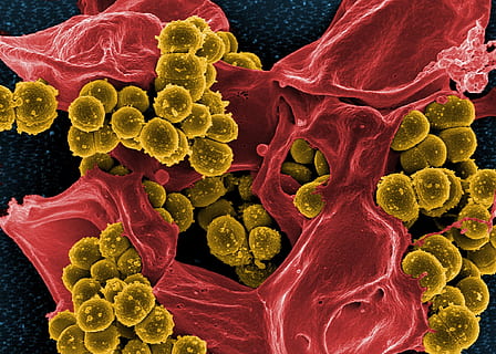 microscopic, photograph, bacteria, electron microscope, stained, green, staphylococcus aureus, spheroid, methicillin resistant, mrsa, bacterium, white blood cell, neutrophil, red, health, microbiology, infection, macro, science, biology, magnification, healthcare and medicine, blood, three dimensional, medical condition, illness, no people, research, medicine, close-up, cancer - illness, virus, indoors, biochemistry, black background, 1080P, CC0, public domain, royalty free