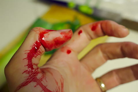 wound hand, blood, untitled, accident, bleed, bleeding, bleeding finger, chopping, chopping board, cut, cutting board, emergency, finger, health care, health-care, hurt, injured, injury, kitchen, knife, medical, pain, red, slicing, thumb, wound, human body part, selective focus, close-up, healthcare and medicine, human hand, hand, body part, one person, food, indoors, food and drink, red nail polish, human finger, fruit, adult, healthy eating, holding, nail, human limb, 2K, CC0, public domain, royalty free