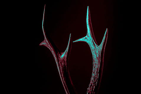 brown, beige, antler, dark, horn, sharp, red, no people, black background, human body part, healthcare and medicine, anatomy, studio shot, indoors, bone, body part, close-up, hospital, motion, medical x-ray, shape, medical exam, tomography, x-ray image, limb, colored background, people, mri scan, 5K, CC0, public domain, royalty free