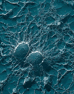 teal, white, decor, bacteria, cocci, staphylococci, staphylococcus, pathogens, disease, electron microscopy, electron micrograph, science, magnification, infection, infect, infected, risk, contagious, risk of infection, vaccination, full frame, backgrounds, no people, pattern, day, blue, nature, close-up, high angle view, water, transparent, outdoors, glass - material, turquoise colored, textured, white color, beauty in nature, cracked, abstract, swimming pool, purity, 720P, CC0, public domain, royalty free