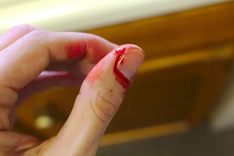 nærbillede fotografering, fingernegl, blod, ulykke, bløde, blødende, blødende finger, håndvask, skære, nødsituation, finger, sundhedspleje, gøre ondt, tilskadekomne, skade, køkken, kniv, medicinsk, smerte, rød, udskæring, tommelfinger, sår, menneskelig hånd, tæt på, menneskelig finger, menneskelig kropsdel, hånd, en person, fysisk skade, kropsdel, sundhedspleje og medicin, indendørs, bedrift, fokus på forgrunden, lemmer, voksen, søm, menneskelig lem, håndled, humant blod, 2K, CC0, offentligt domæne, royaltyfrie
