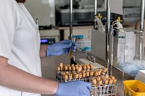 person, holding, glass vial, laboratory, analysis, diagnostics, hospital, tube, the test, research, medical, the doctor, medic, test, tests, treatment, blood, the patient, diagnostician, health, occupation, indoors, one person, preparation, protective glove, adult, business, working, real people, midsection, protective workwear, factory, healthcare and medicine, protection, food and drink, food, industry, bread, skill, manufacturing equipment, quality control, 2K, CC0, public domain, royalty free