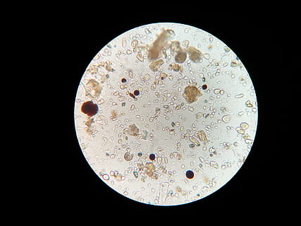 microscopic image, soil microbes, microscope, soil sample, science, black background, biology, circle, geometric shape, magnification, education, shape, optical instrument, laboratory equipment, research, microbiology, healthcare and medicine, studio shot, indoors, scientific experiment, extreme close-up, no people, 4K, CC0, public domain, royalty free