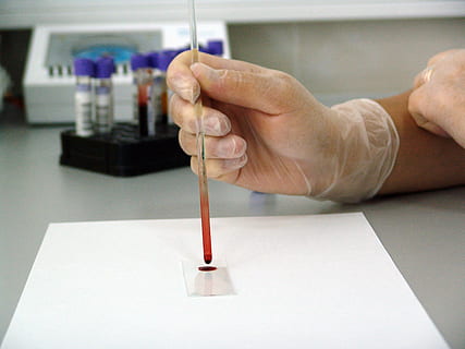 person, wearing, white, gloves, holding, clear, glass hand tool, blood, sample, lab, laboratory, medical, drop, glass, research, hospital, biology, experiment, scientist, analyzing, liquid, glove, test, medicine, healthcare, science, analysis, scientific, doctor, clinic, clinical, human Hand, indoors, human body part, hand, table, one person, close-up, real people, body part, focus on foreground, art and craft, human finger, finger, unrecognizable person, education, paper, brush, 2K, CC0, public domain, royalty free